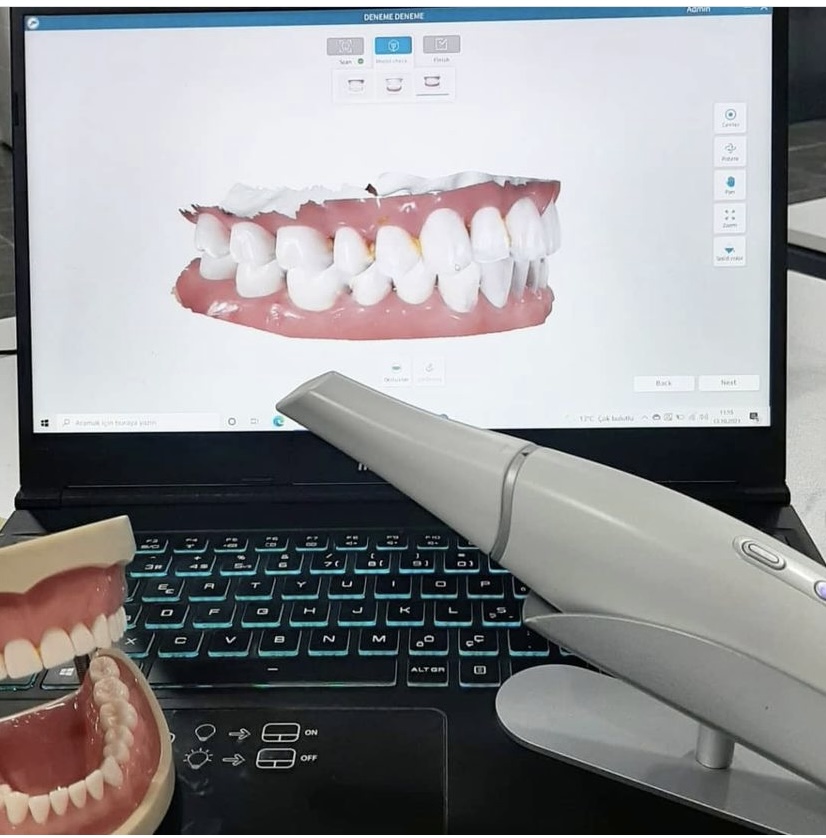 3D Intra Oral Scanner KOMPLETT-SYSTEM  DIGISMILE Jubiläumsangebot 50 Jahre