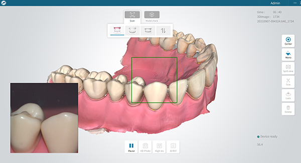3D Intra Oral Scanner KOMPLETT-SYSTEM  DIGISMILE Jubiläumsangebot 50 Jahre